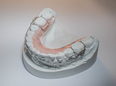 aparat ortodontyczy typu Płytka retencyjna